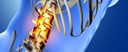 Spinal Deformities Expertise | Dr Jwalant Mehta