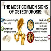 Buy Osteoporosis Treatment Medication Online Globally